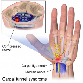 Best Mouse for Carpal Tunnel 2021- Ergonomic Mouse