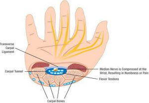 best ergonomic keyboard carpal tunnel